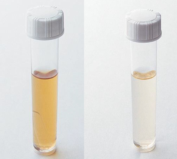 糞便系大腸菌群用 EC液体培地