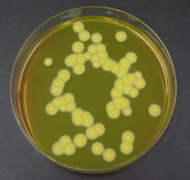 黄色ブドウ球菌