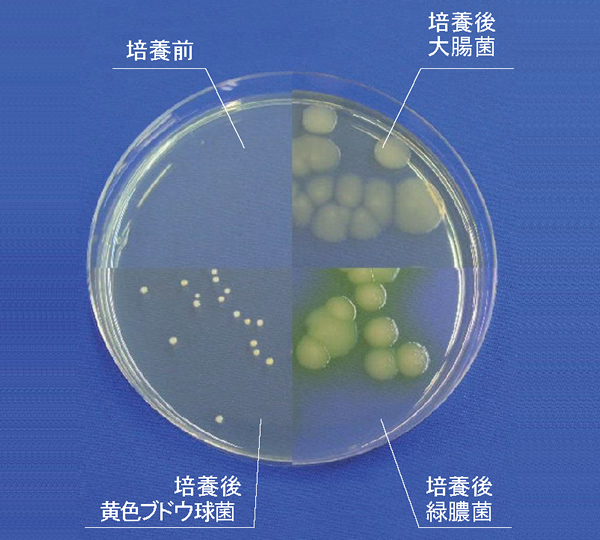 総好気性微生物用　生培地SCD寒天培地